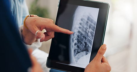 Image showing Tablet in hands, lung xray and healthcare, analysis and radiology with doctor and patient at hospital. People with technology, health and surgery, cardiology and anatomy with assessment of scan
