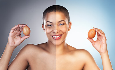 Image showing I have something thatll restore your skin to a healthier state. Before and after concept of a young woman holding up two eggs.