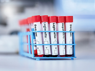 Image showing Blood in test tube, health and sample for experiment with medical research in lab. Science, healthcare and check DNA for virus or bacteria, scientific study and pathology, investigation and biotech