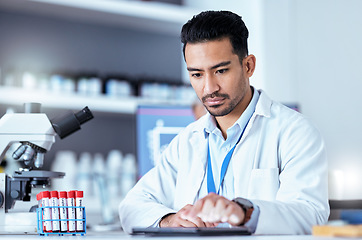 Image showing Scientist man, tablet and typing in laboratory with thinking, medical research and blood for pharma development. Young pharmaceutical expert, digital touchscreen or focus for innovation in healthcare