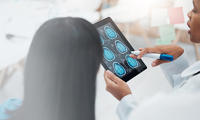 Image showing Doctors, tablet screen and neurology mockup team talking healthcare and brain analysis. Medical expert women hands with technology for mri assessment, research and innovation for health therapy plan