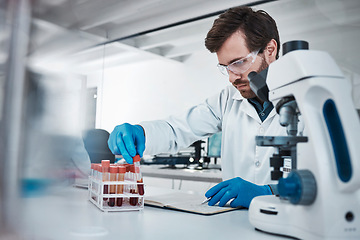 Image showing Working in laboratory, person studying chemical sample in blood test tube and research biotechnology in Germany. Expert pathology scientist, liquid solution and focus on career in medical science