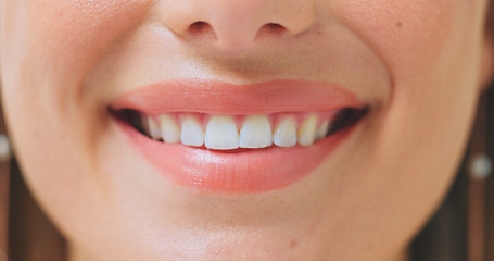 Image showing Dental, zoom and woman smile with teeth whitening, results or oral hygiene treatment. Mouth, closeup and female person happy with breath, tooth or gum cleaning, veneers or orthodontics satisfaction