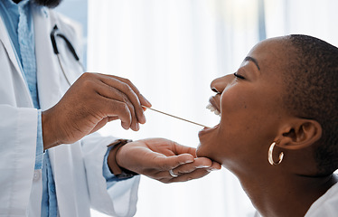 Image showing Doctor, otolaryngologist or dentist with a medical instrument checking the throat for tonsils or oral cancer. Health, healthcare worker and wellness with an ent specialist examining a black woman