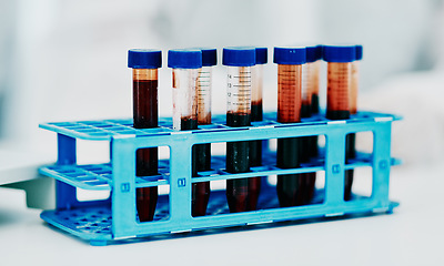 Image showing Closeup blood, test tube or medical research in science laborary for testing, checking or examining DNA sample. Searching for breakthrough cure for marburg virus, monkeypox or global pandemic disease