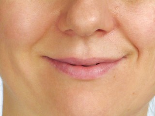 Image showing Correction of wrinkles on half of face