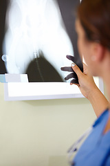 Image showing Woman, veterinarian and doctor with xray of animal for examination, tests or diagnosis on injury at vet. Female person, nurse or medical pet professional looking at CT scan or MRI for clinic checkup