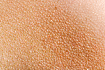 Image showing Goosebumps Skin Background