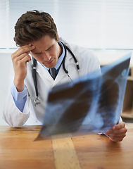 Image showing Doctor, man and check xray, headache and stress in healthcare, medical diagnosis and review of lung scan at cardiology clinic. Radiology, assessment of MRI results and bad news with surgeon