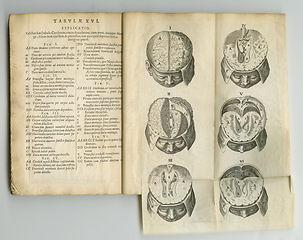 Image showing Vintage, brain and antique medical book on anatomy bones, medicine treatment research or head trauma support. Latin journal, healthcare or skull diagram sketch for historical neurosurgery guide