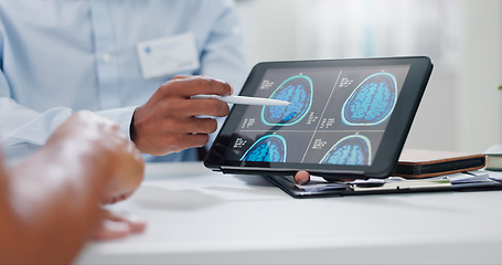 Image showing Doctor, hands and tablet with brain scan for patient, consultation or examination results at hospital. Closeup of person, medical employee or nurse pointing to technology for MRI at neurology clinic