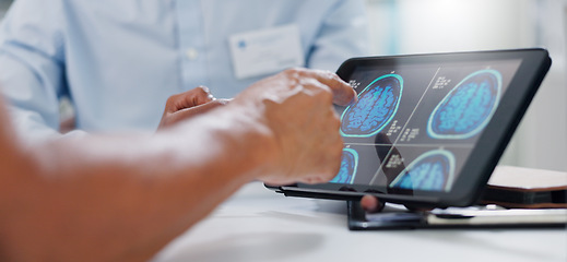 Image showing Doctor, hands and tablet with brain scan for patient, consultation or examination results at hospital. Closeup of person, medical employee or nurse pointing to technology for MRI at neurology clinic
