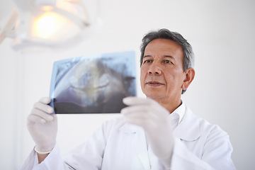 Image showing Mature dentist, man and xray of teeth for dental surgery, healthcare and oral health with treatment at clinic. Medical professional with analysis of scan, review and orthodontics with mouth care