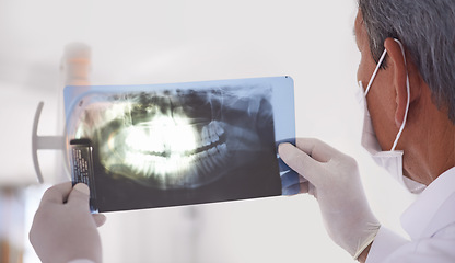 Image showing Dentist, man and xray closeup of teeth for dental surgery, healthcare and oral health at clinic. Medical professional with analysis of scan, radiology and orthodontics for mouth care with treatment