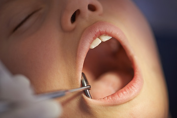 Image showing Closeup, child and dentist with mirror in mouth for gum disease and oral hygiene with dental inspection. Medical, orthodontics and consultation for teeth health, cleaning and wellness with instrument