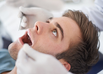 Image showing Dental, man and dentist with tools for healthcare, gum disease and oral hygiene with mouth inspection. Medical, orthodontics and consultation for teeth health, cleaning and wellness with excavator