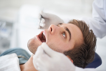 Image showing Man, hands and dentist with tools for healthcare, gum disease and oral hygiene with mouth inspection. Medical, orthodontics and consultation for teeth health, cleaning and wellness with excavator