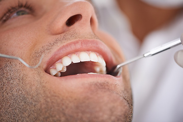 Image showing Closeup, man and dentist with tools in mouth for gum disease and oral hygiene with dental inspection. Medical, orthodontics and consultation for teeth health, cleaning and wellness with instrument