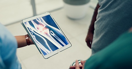 Image showing Doctor, results or hands with tablet or bone in consultation for physical therapy or medical information. Screen, broken or doctor speaking of knee injury or accident to patient for rehabilitation