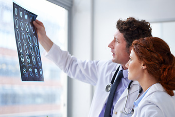 Image showing Doctors, brain scan and check results at hospital with teamwork, review and healthcare by window. Neurology, man and woman with xray reading for wellness, ideas and decision with document in clinic