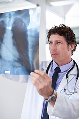 Image showing Doctor, man and xray in hospital to check results with thinking for lungs, decision and healthcare. Professional medic, reading and film paper with respiratory system exam for asma at wellness clinic