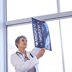 Image showing Woman, mature doctor and study xray for planning medical treatment, surgery and healthcare at hospital. Brain scan, neurology and radiology with surgeon for health assessment, anatomy and MRI