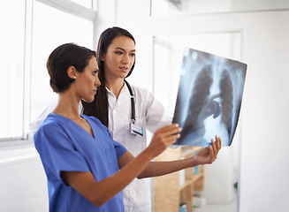 Image showing X ray, doctor and nurse with results in hospital, medical facility or clinic for lung exam or radiology. Women, people and healthcare workers with document, research or analysis of respiratory system