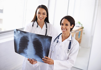 Image showing Portrait, x ray and doctors with results in hospital, medical facility or clinic for lung exam. Women, people or healthcare workers with radiology document, research or analysis of respiratory system