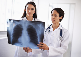 Image showing Radiology, x ray or doctors with results in hospital, medical facility or clinic for lung exam or health. Women, people or healthcare workers with document, research or analysis of respiratory system