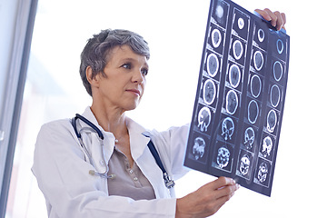 Image showing Woman, mature doctor and review xray for planning medical treatment, surgery and healthcare at hospital. Brain scan, neurology and radiology with surgeon for health assessment, anatomy and MRI