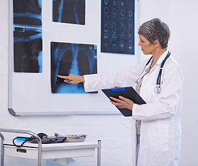 Image showing Senior doctor, woman and medical xray with clipboard for checklist, assessment and radiology for surgery. Lungs, cardiology and anatomy scan for healthcare with surgeon at treatment plan at clinic