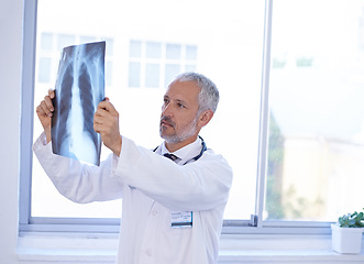 Image showing Hospital, thinking and doctor with x ray for research, medical service or surgery review. Healthcare, radiology clinic and senior health worker with anatomy scan for analysis, diagnosis or consulting