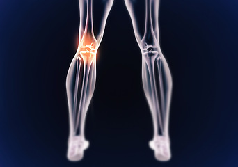 Image showing Legs, skeleton and red pain with graphic for xray, exam and analysis in healthcare overlay and dark or black background. 3D of anatomy, radiology and knee or joint illustration for injury and physio