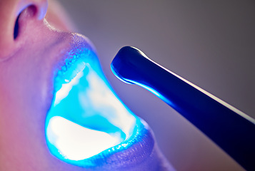 Image showing Closeup, child and dentist with tools in mouth for gum disease, oral hygiene and dental inspection. Consultation, orthodontics and young girl with ultraviolet light for cleaning, treatment and care