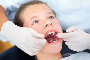 Image showing Girl, kid and mirror for inspection at dentist for healthcare with dental tool, consultation and checkup for oral health. Expert, child and glove hand for teeth cleaning, gingivitis and medical care