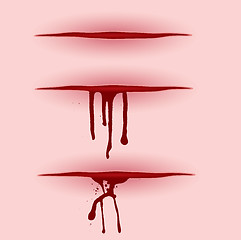 Image showing blood cut