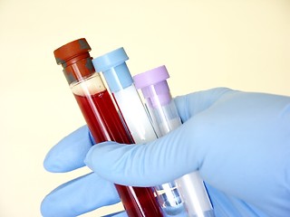 Image showing blood test #2