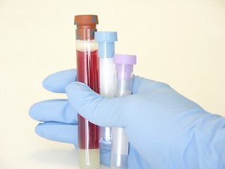 Image showing blood work