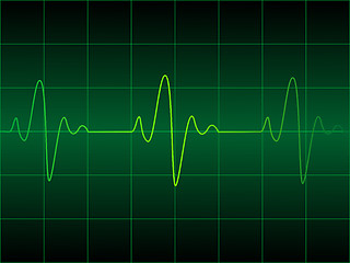 Image showing Heart cardiogram 