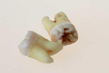 Image showing third molars