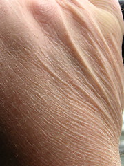 Image showing aging skin