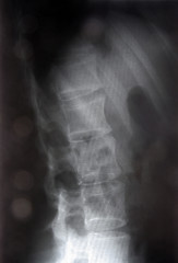 Image showing X-ray