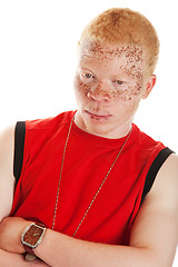 Image showing Albino Man