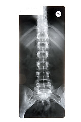 Image showing X-ray