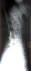 Image showing X-ray