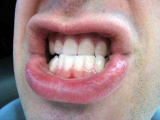 Image showing angry mouth