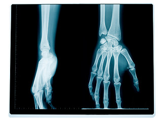 Image showing Hand and wrist radiography