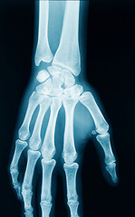 Image showing Hand x-ray