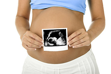 Image showing Pregnancy