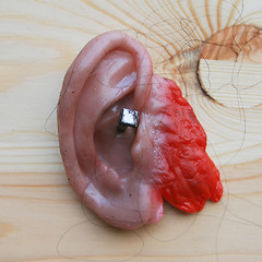 Image showing Severed Ear